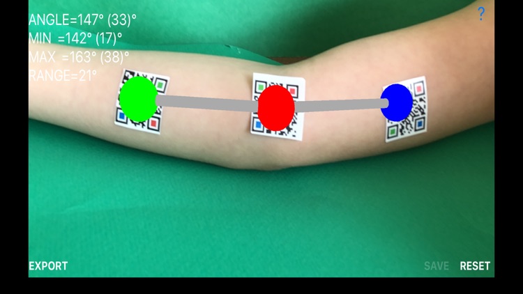 DynamicGoniometerAR screenshot-3