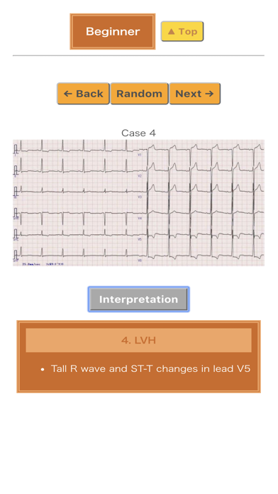 How to cancel & delete Pocket ECG from iphone & ipad 2