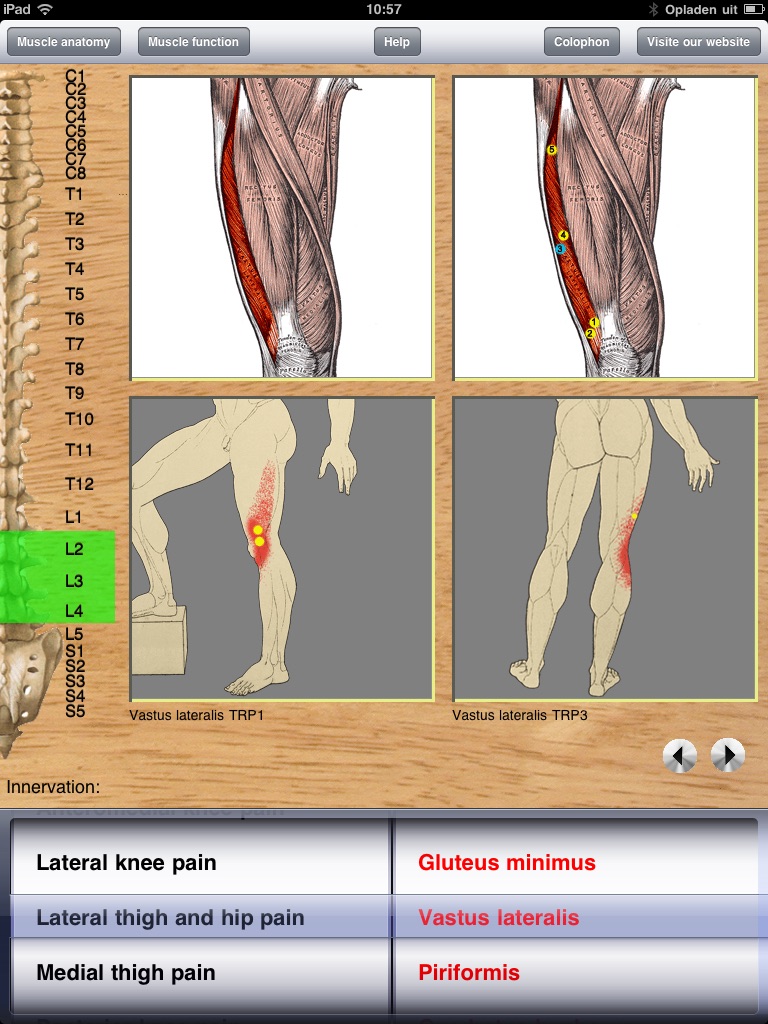 Dry Needling Pro screenshot 2