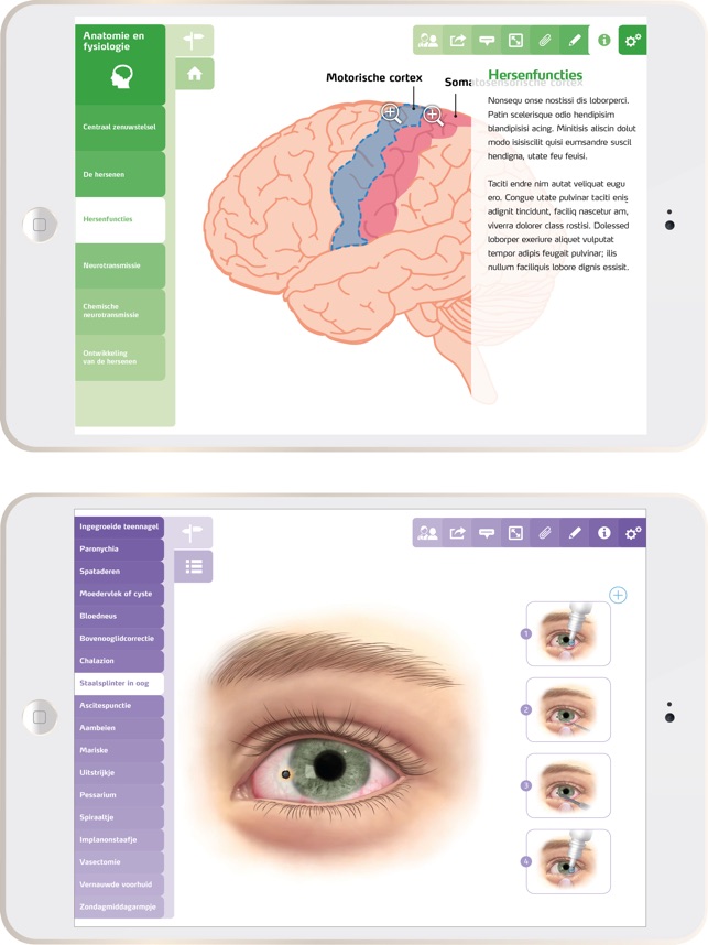 Zorgatlas(圖4)-速報App