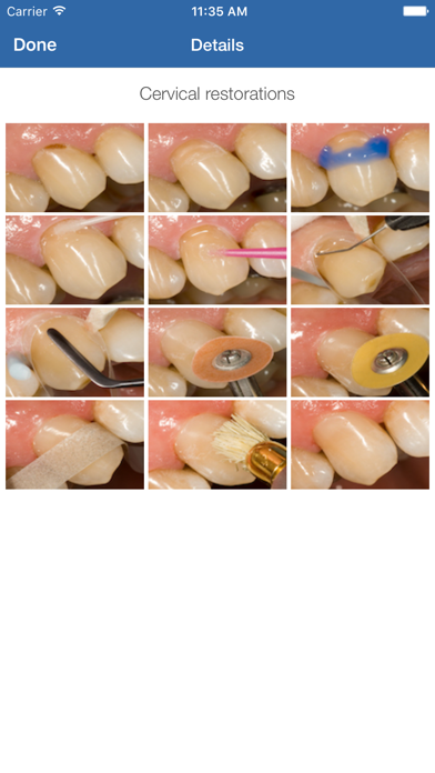Dental Composite screenshot 2