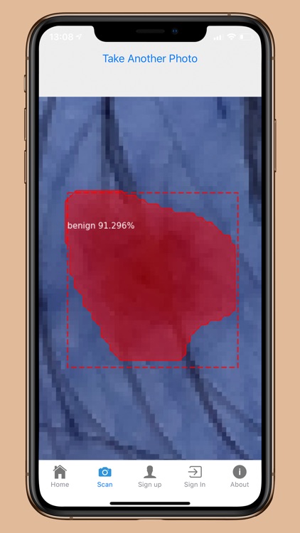 DermoScanner screenshot-7