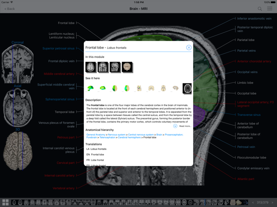 IMAIOS e-Anatomy screenshot