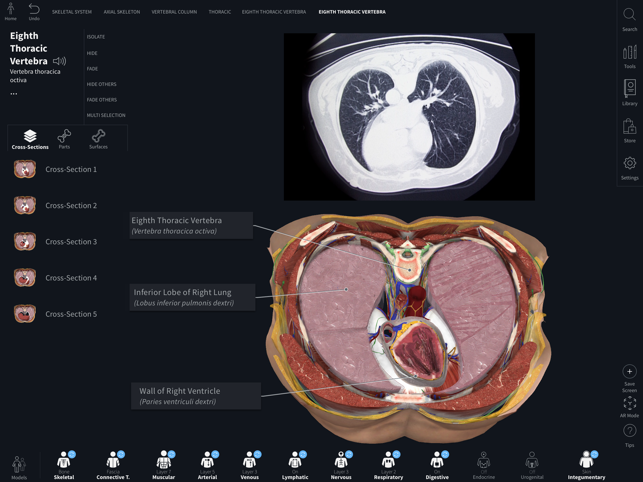 Complete Anatomy 19 for iPad(圖4)-速報App