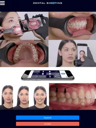 Captura de Pantalla 1 Dental Shooting iphone