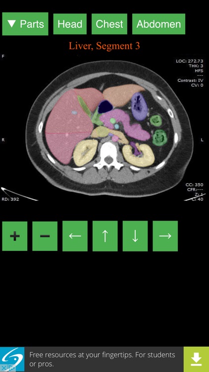 Anatomy on Radiology CT