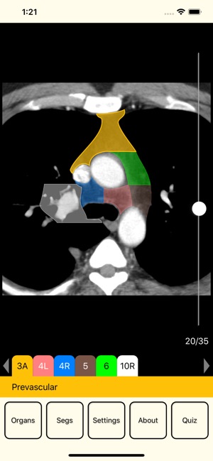 RadAnatomy(圖1)-速報App