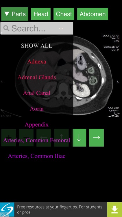 Anatomy on Radiology CT