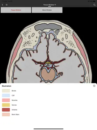 Captura de Pantalla 5 MedImaging-Radiology Made Easy iphone