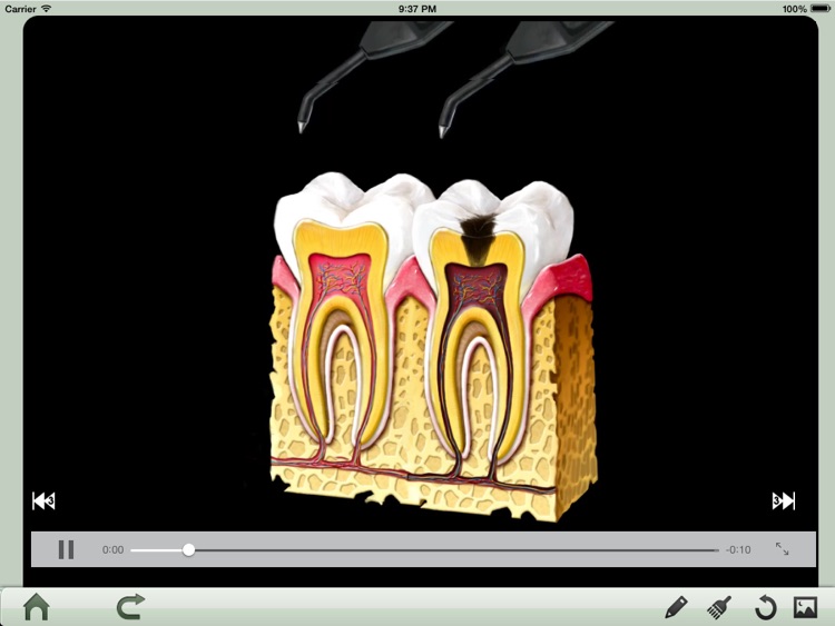 Dental iClinic Lite (J) screenshot-3