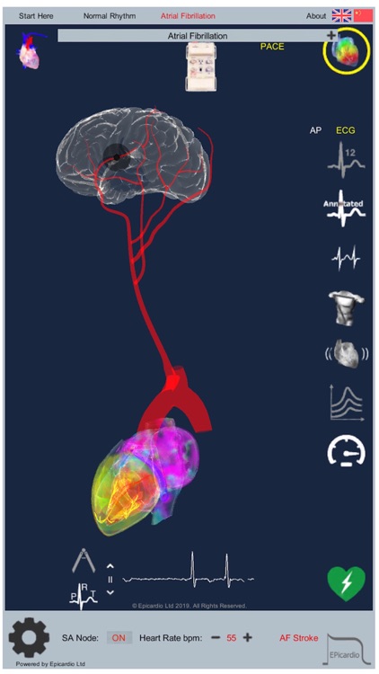 Intelligent Heart Sim AFib screenshot-7