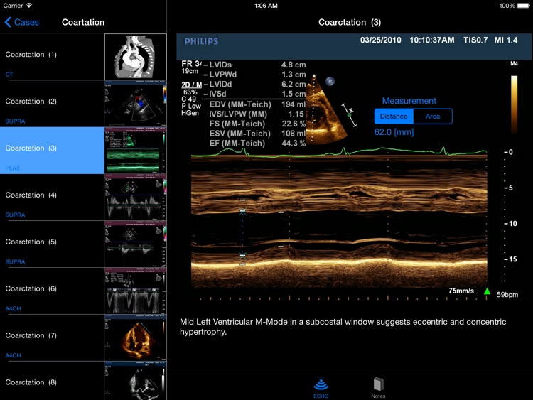 CARDIO3®Echocardiography HD