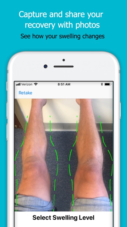 RecovAware Knee Health Fitness screenshot-4