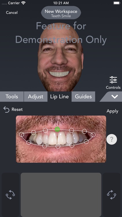 Bellus3D Dental Pro screenshot-4