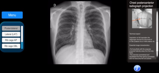 Anatomy and X-Ray Positioning(圖4)-速報App