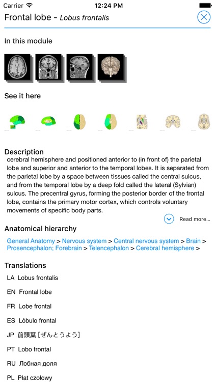 IMAIOS e-Anatomy screenshot-3
