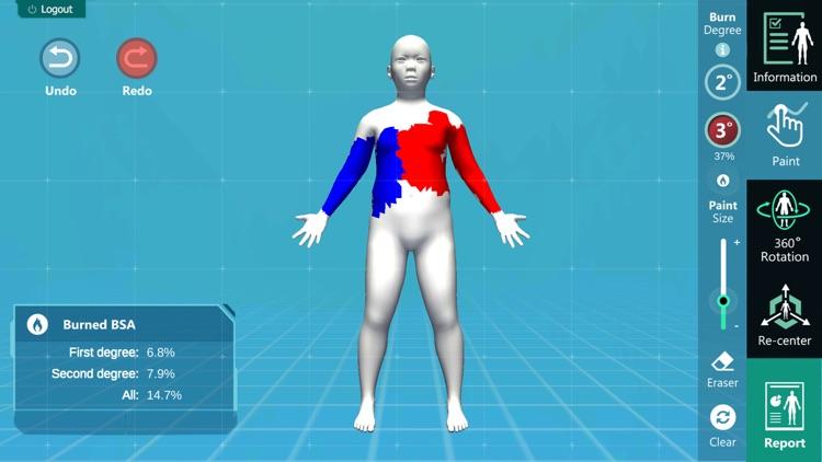 3D PED Burn Resuscitation screenshot-4