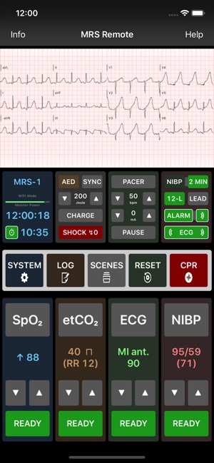 Medical Rescue Sim Remote(圖2)-速報App