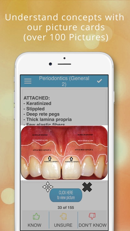 Periodontics (NBDE iNBDE)