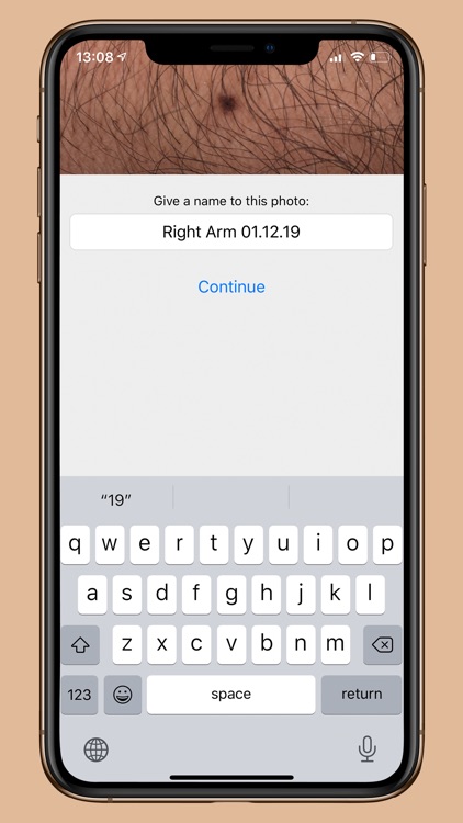 DermoScanner screenshot-4