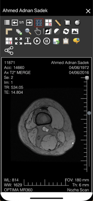 Alfa Scan Portal(圖4)-速報App