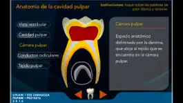 Game screenshot Pulpotomía Académico apk
