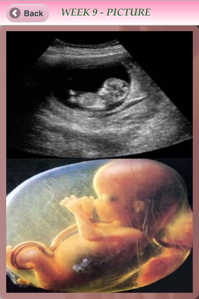 Pregnancy Info - Lite screenshot 2
