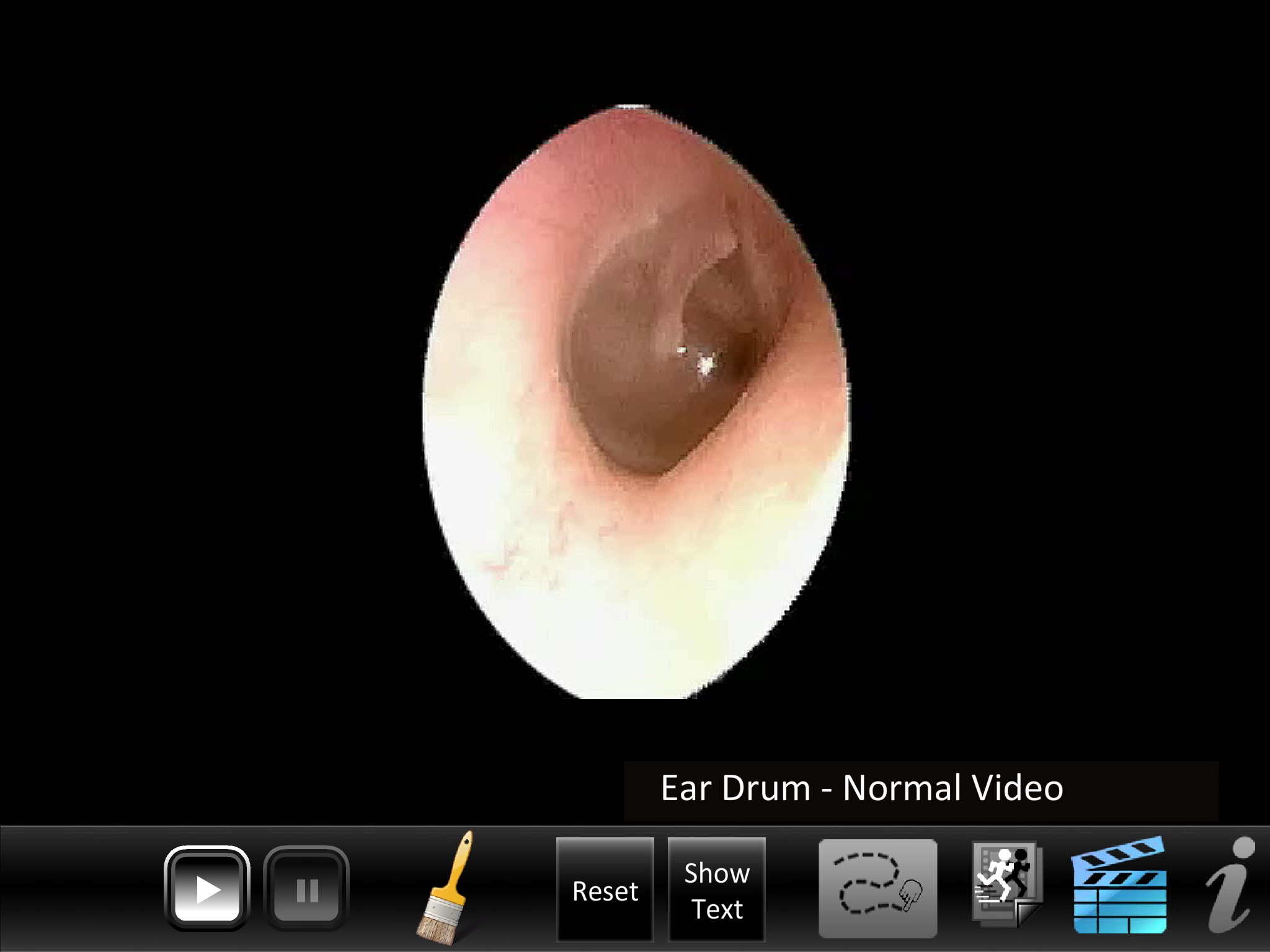 Ear ID screenshot 4