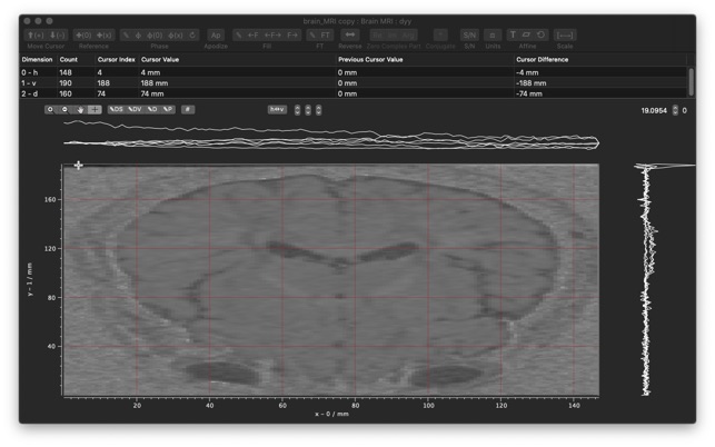 Download rmn for mac 4 free Download rmn for mac 4 free