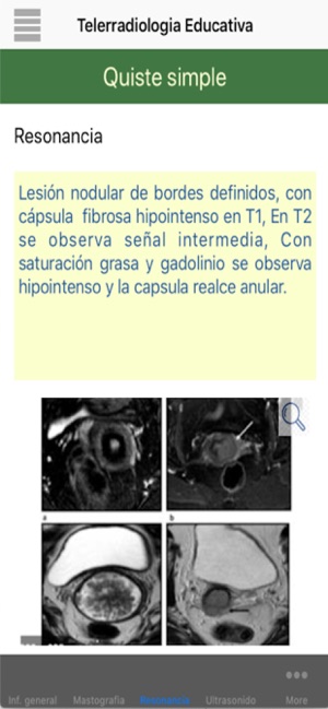 Telerradiología -Educativa(圖4)-速報App