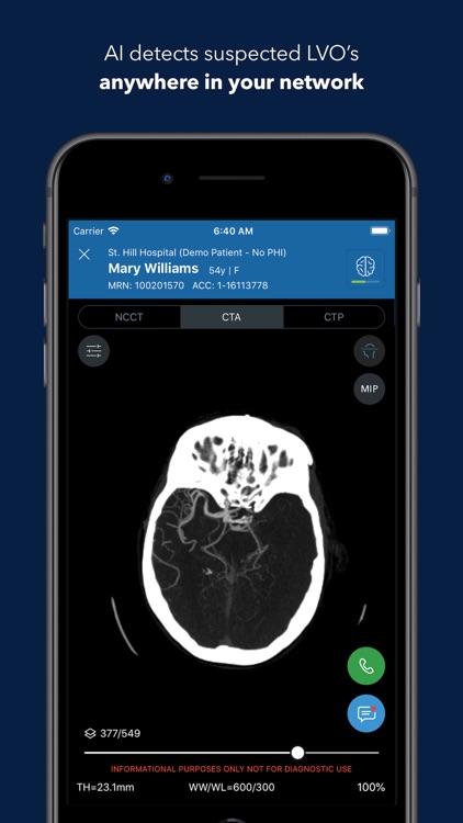 Viz Training AI Stroke Care