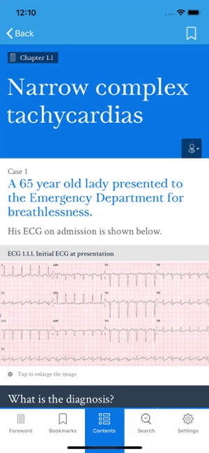 Dr ECG(圖2)-速報App