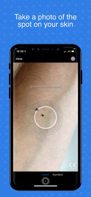 SkinVision Detect Skin Cancer(圖1)-速報App