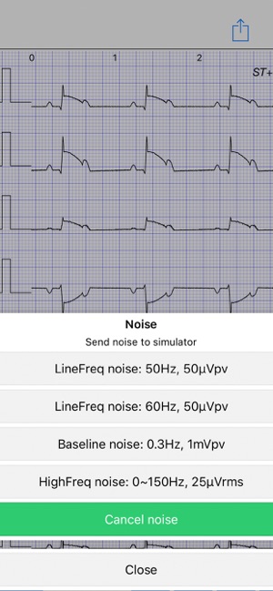 ECG Simulator(圖3)-速報App