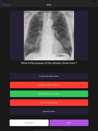 Captura de Pantalla 5 Basic Radiology iphone