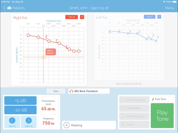 SHOEBOX Audiometry Pro