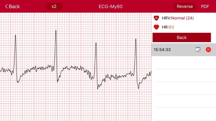 imedtrack