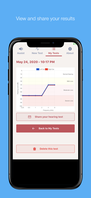 HearBetter Amplification(圖2)-速報App