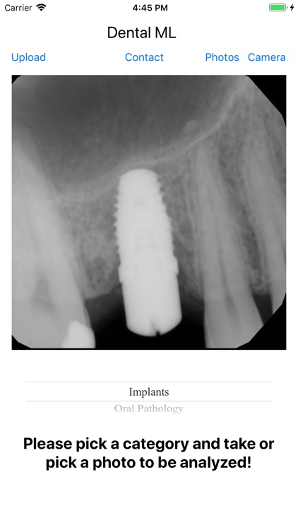 Dental ML