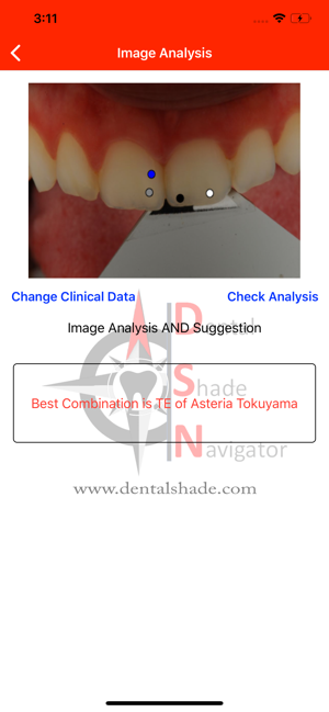 Dental Shade Navigator(圖3)-速報App