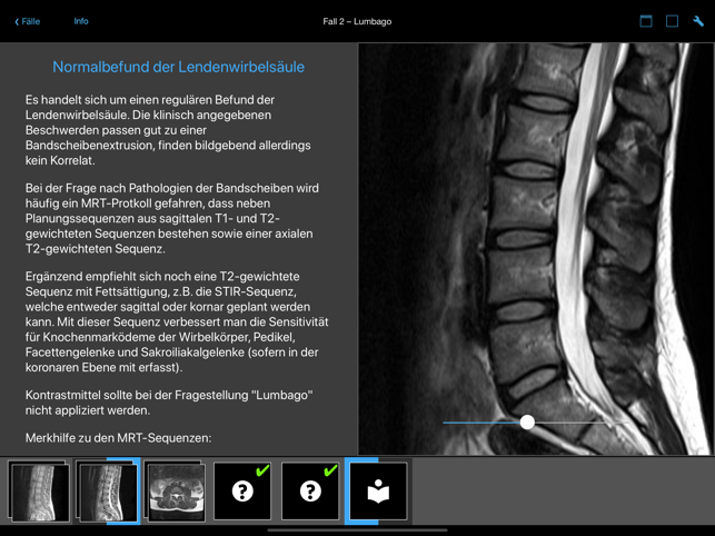 BerlinCaseViewer(圖4)-速報App