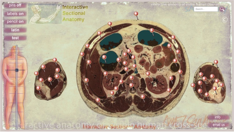 sAnatomy_Play