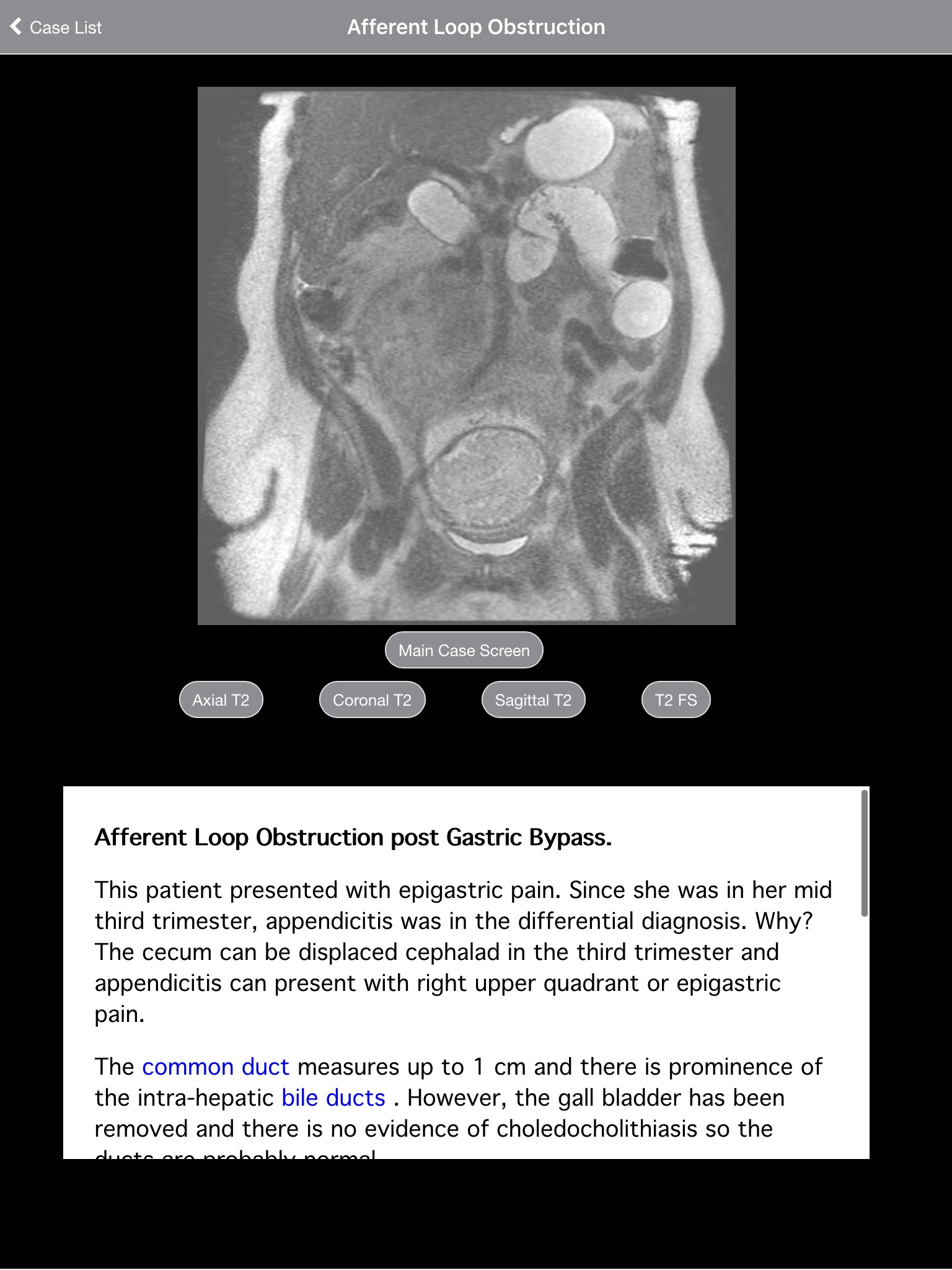 Pregnant Appendicitis screenshot 4
