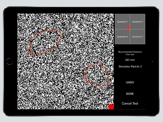 Visual Field Fast Pro(圖3)-速報App