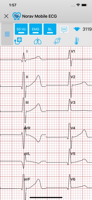 Norav Medical Mobile ECG(圖4)-速報App