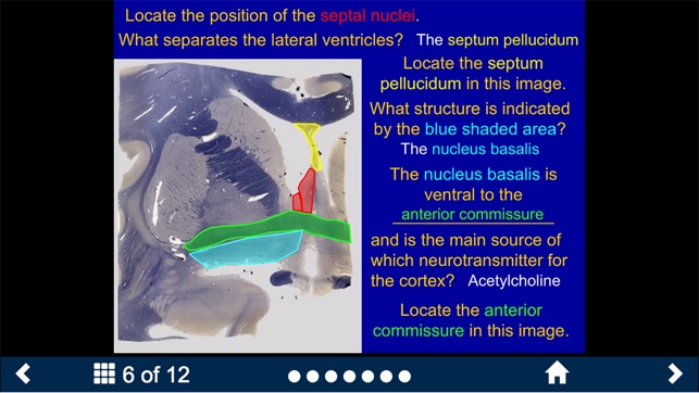 Neuroanatomy Lite - SecondLook(圖3)-速報App