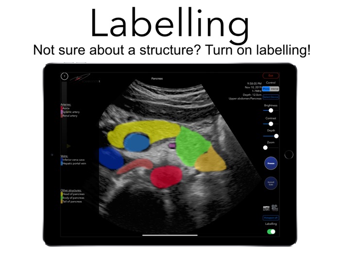 Scanbooster Ultrasound Sim
