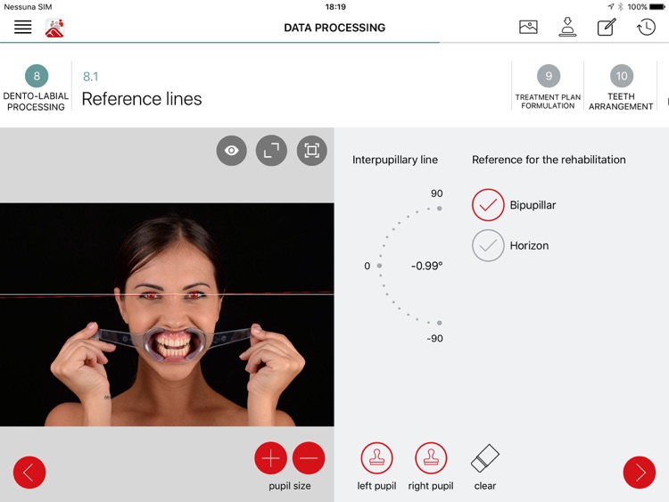 Fradeani App