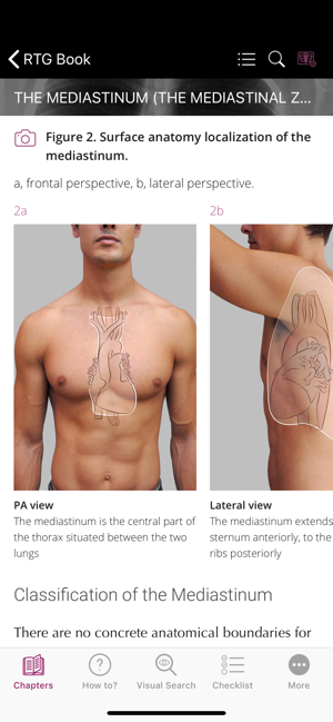 Chest X-ray Interpretation(圖2)-速報App