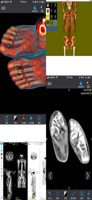 Dicom3D - Easy and Powerful